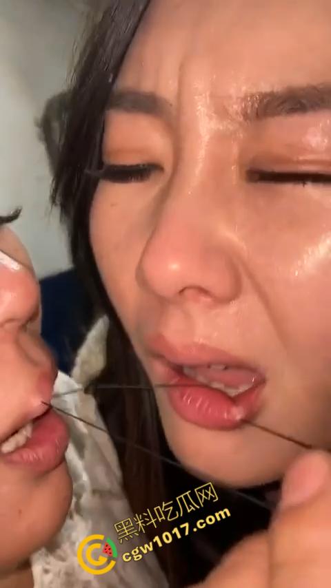 湖南偏僻村庄恐怖游戏：嘴唇缝合，女子痛苦享受，男子冷血针线，极限挑战人，真是够变态-7