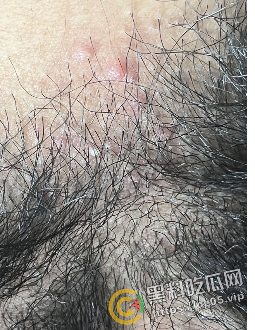 约炮还能买一送一 当拿出一包烟就拿下两个精神小妹的时候这件事注定不简单 直接感染 要长小蘑菇啦-5