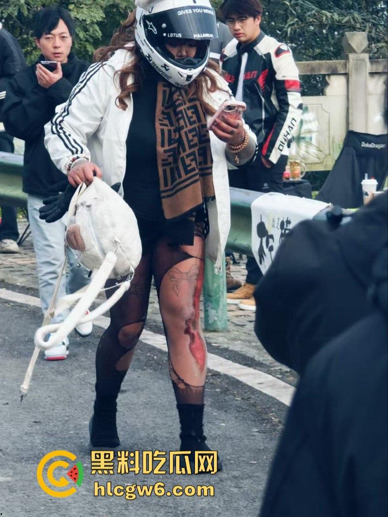 美图秀秀弱爆了 这才是真实磨皮！胖妹装逼压弯失控撞车  黑丝当场爆裂惨遭磨皮 大腿血肉模糊 真是悲惨又丢人！-4